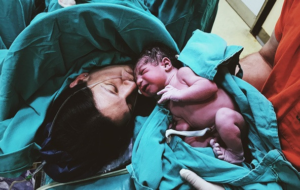 Fizioterapeutkinja: "Ovo su dobre strane carskog reza"