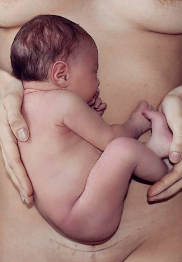 Sarah Savona ziba svojega otroka, kot da je še vedno v maternici, na tej čudoviti fotografiji, ki poudarja njeno hčerko tako kot brazgotino na trebuhu.
