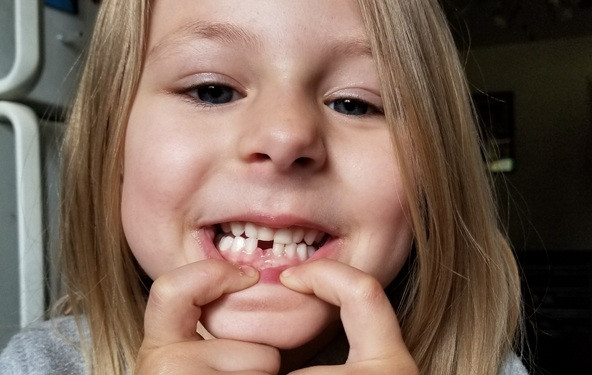 „Pubertet klimavog zuba“